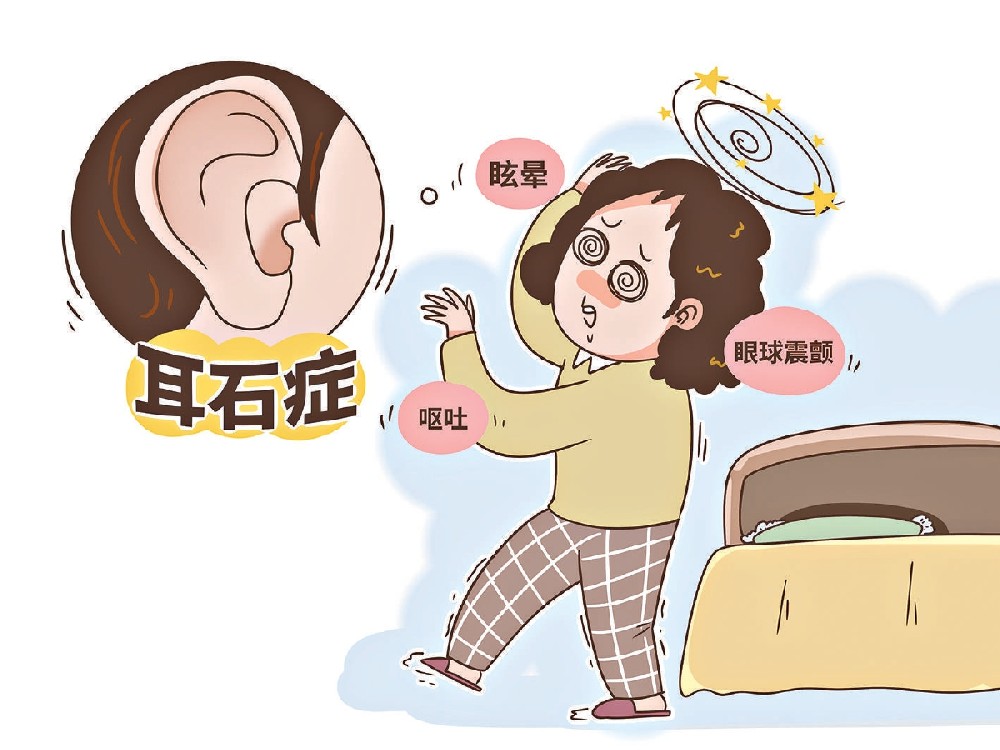 “天旋地转”竟是耳石在捣乱