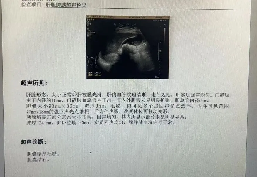efd54e74-c0fe-4ed1-8f45-f38dc3b3c12b.png